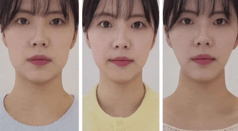 [7월 올영픽/이중턱개선] 마미케어 EMS 브이쎄라 (6 COLOR) 상세페이지 21